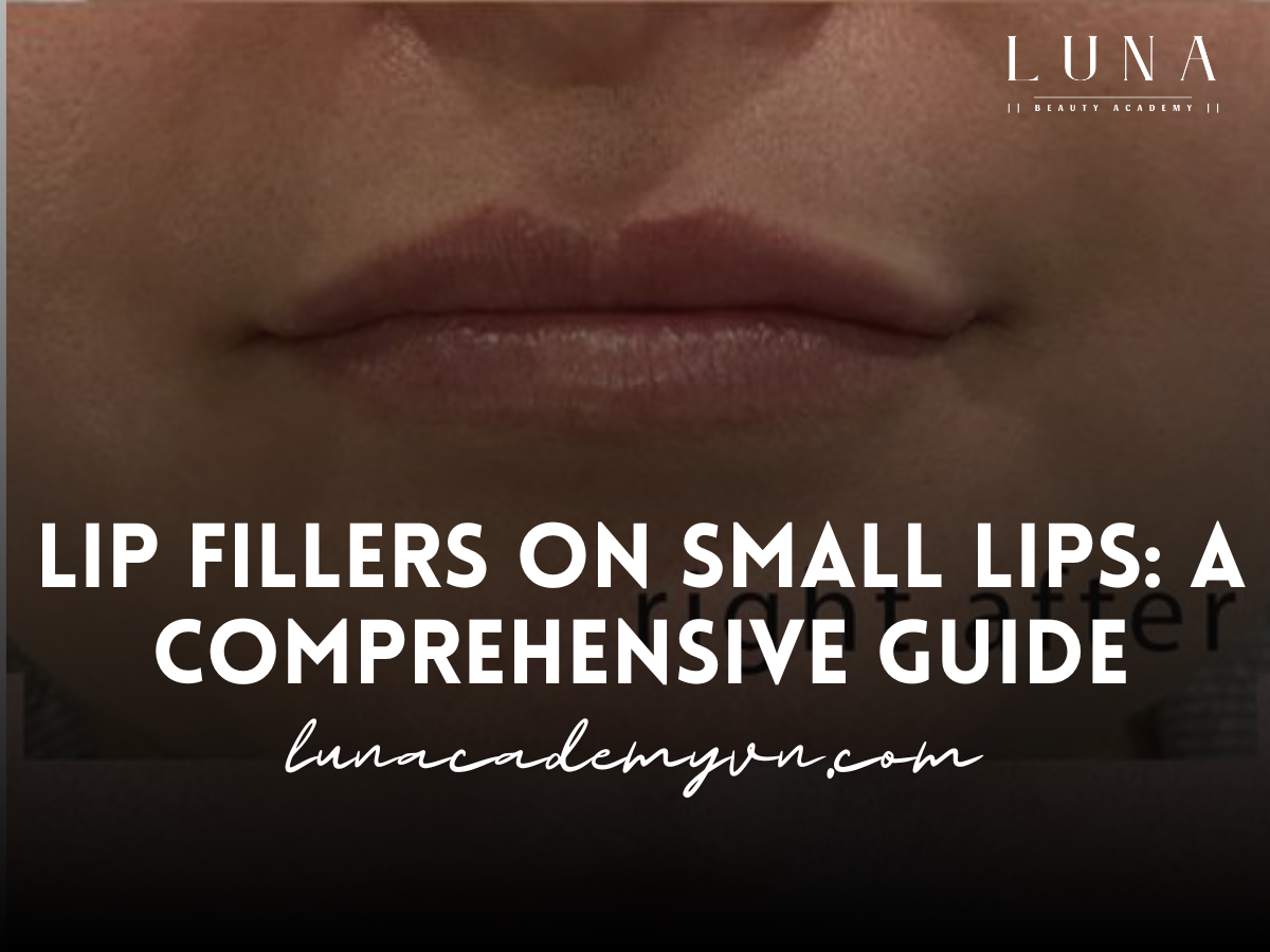 Lip Fillers on Small Lips: A Comprehensive Guide