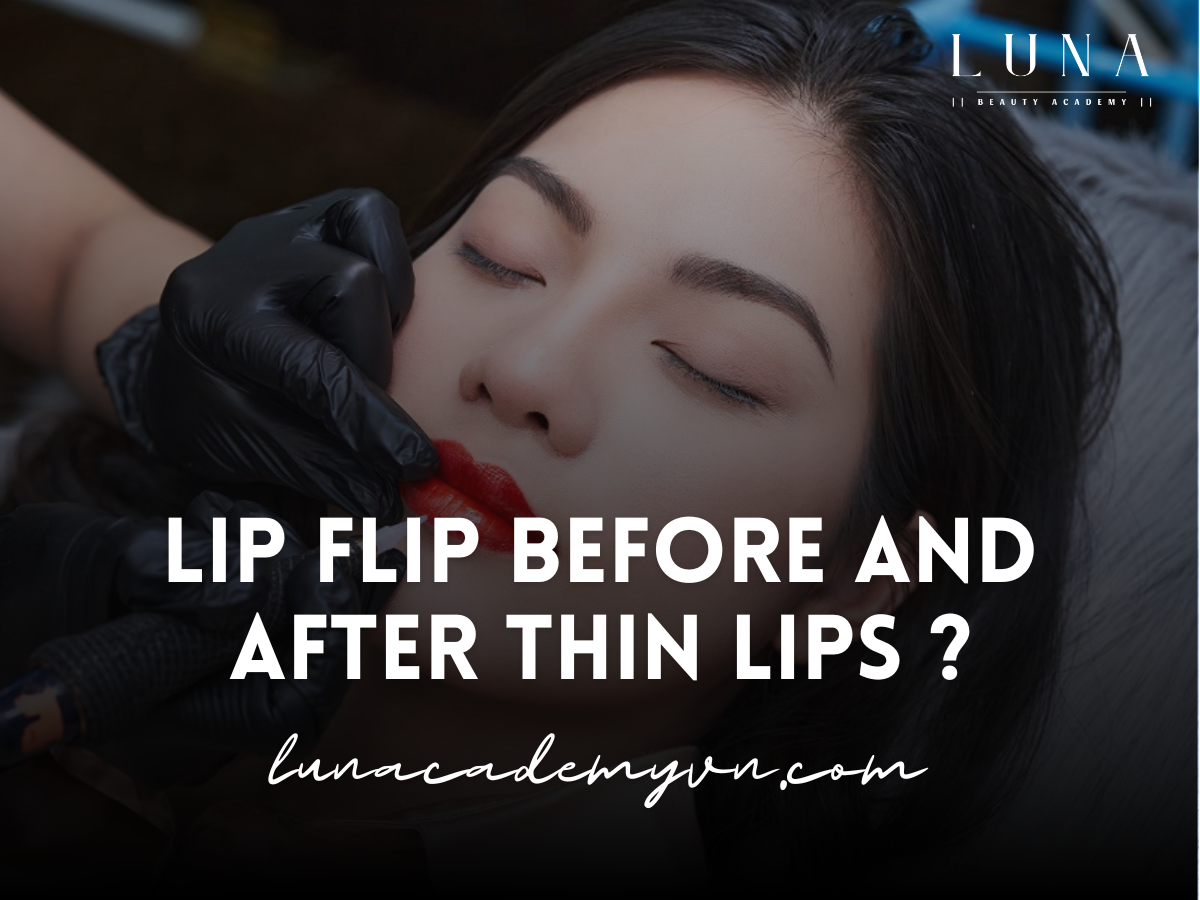 Botox Lip Flip Before and After