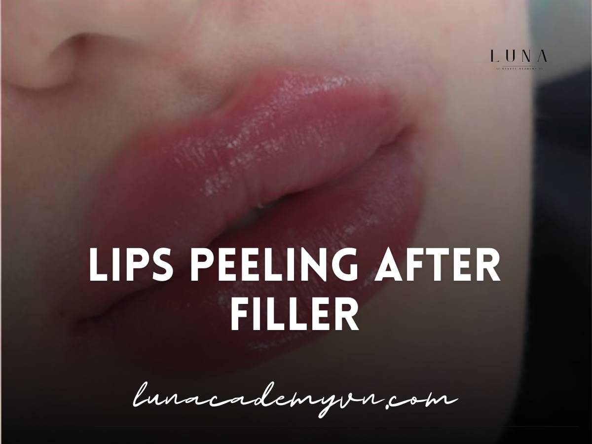 lips peeling after filler