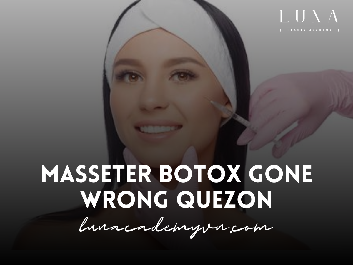 Masseter Botox Gone Wrong Quezon