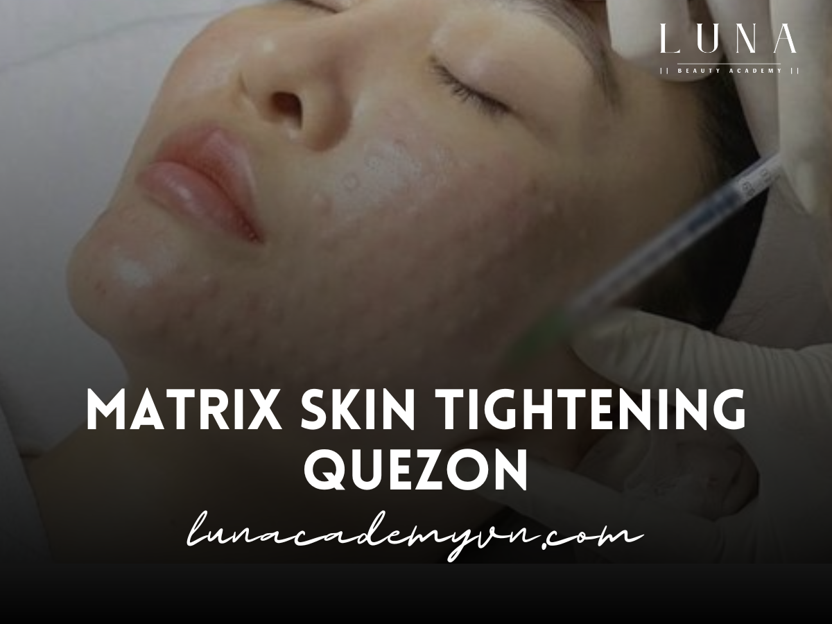 Matrix Skin Tightening Quezon