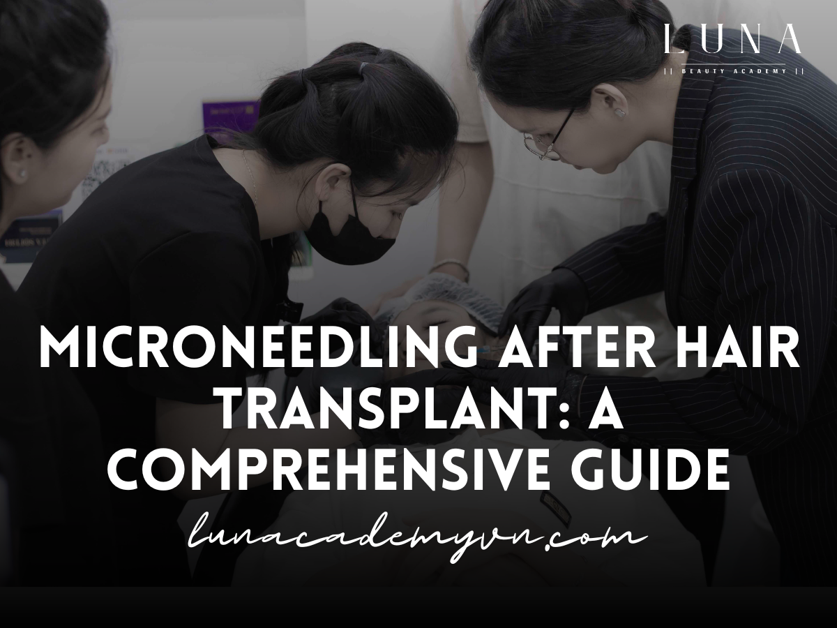 Microneedling After Hair Transplant: A Comprehensive Guide