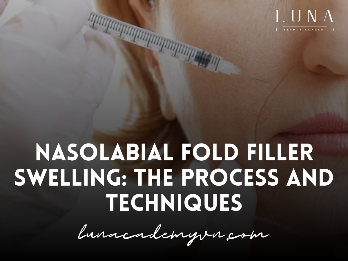 Nasolabial Fold Filler Swelling Stages