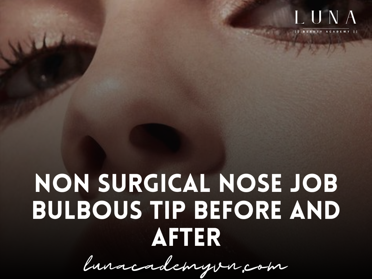 non surgical nose job bulbous tip before and after