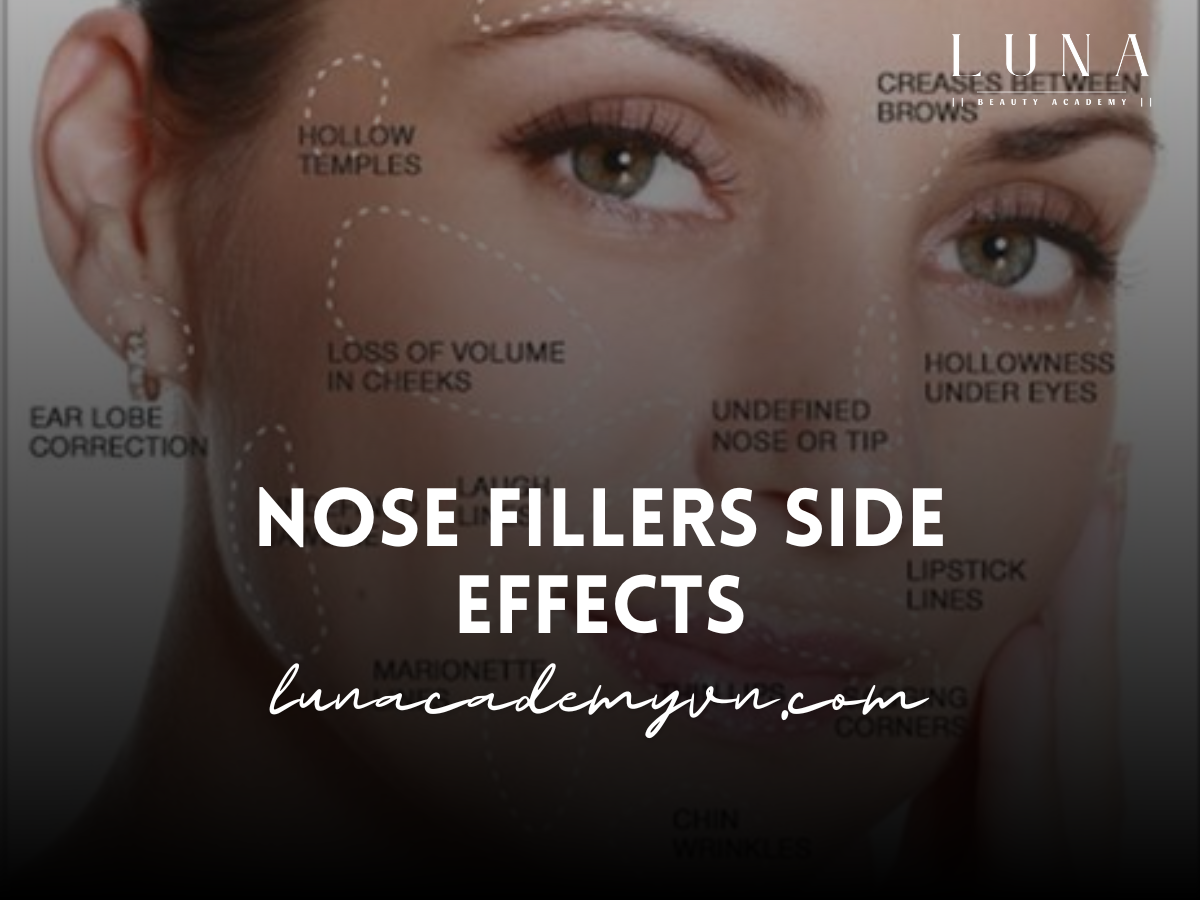 Nose Fillers Side Effects