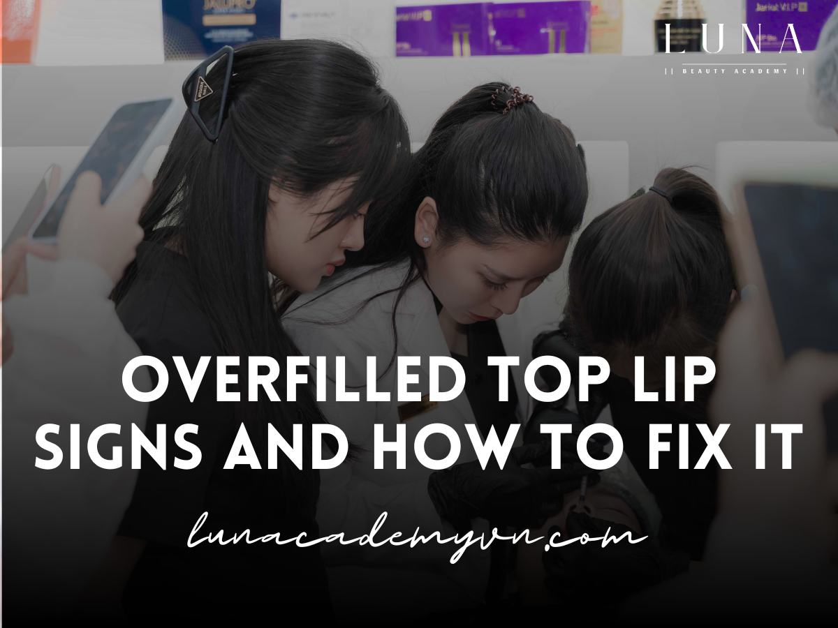 Overfilled Top Lip: Signs and How to Fix It