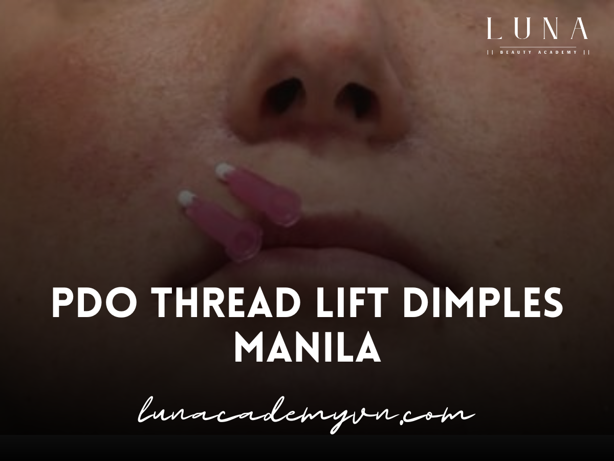 pdo thread lift dimples