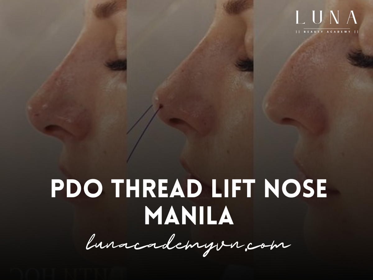 PDO Thread Lift Nose Manila: A Comprehensive Guide