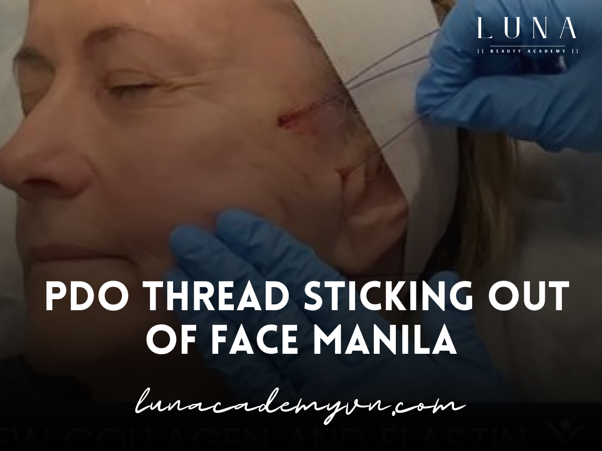 PDO Thread Sticking Out of Face Manila