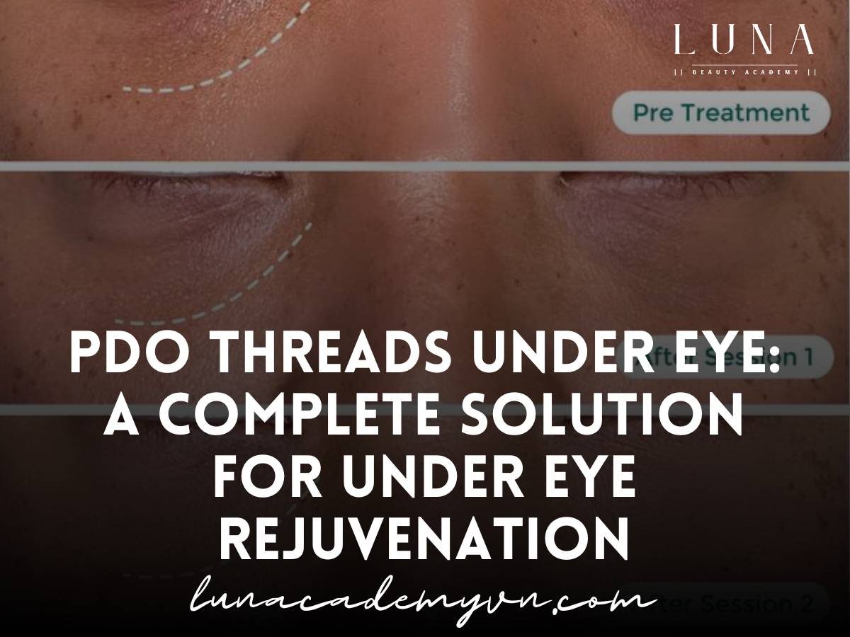 pdo threads under eye