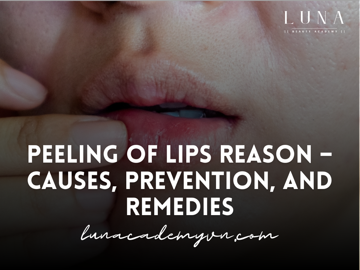 Peeling of Lips Reason – Causes, Prevention