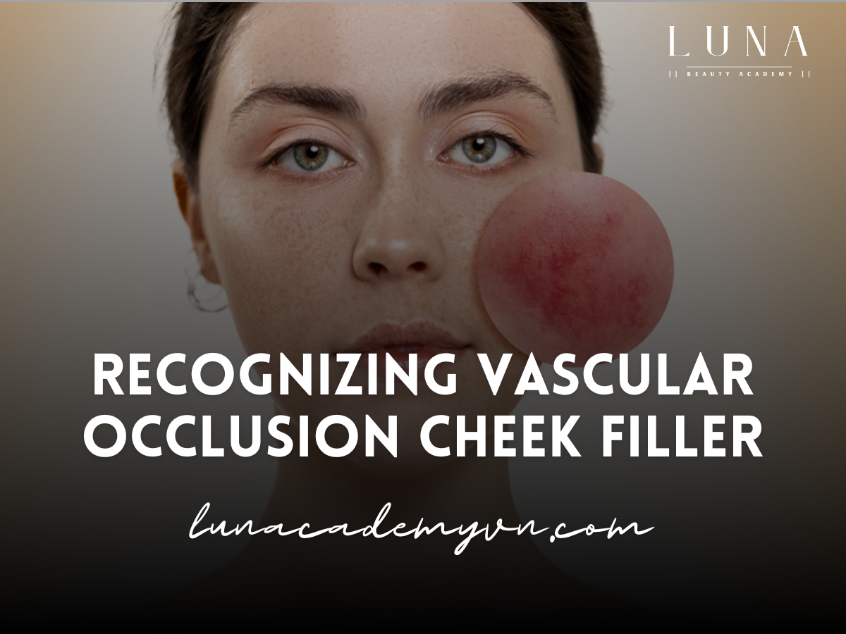 Recognizing Vascular Occlusion Cheek Filler