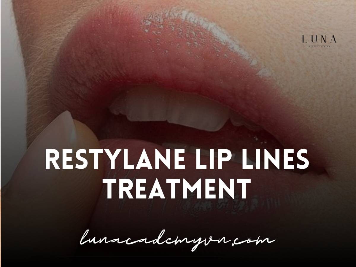 restylane lip lines treatment