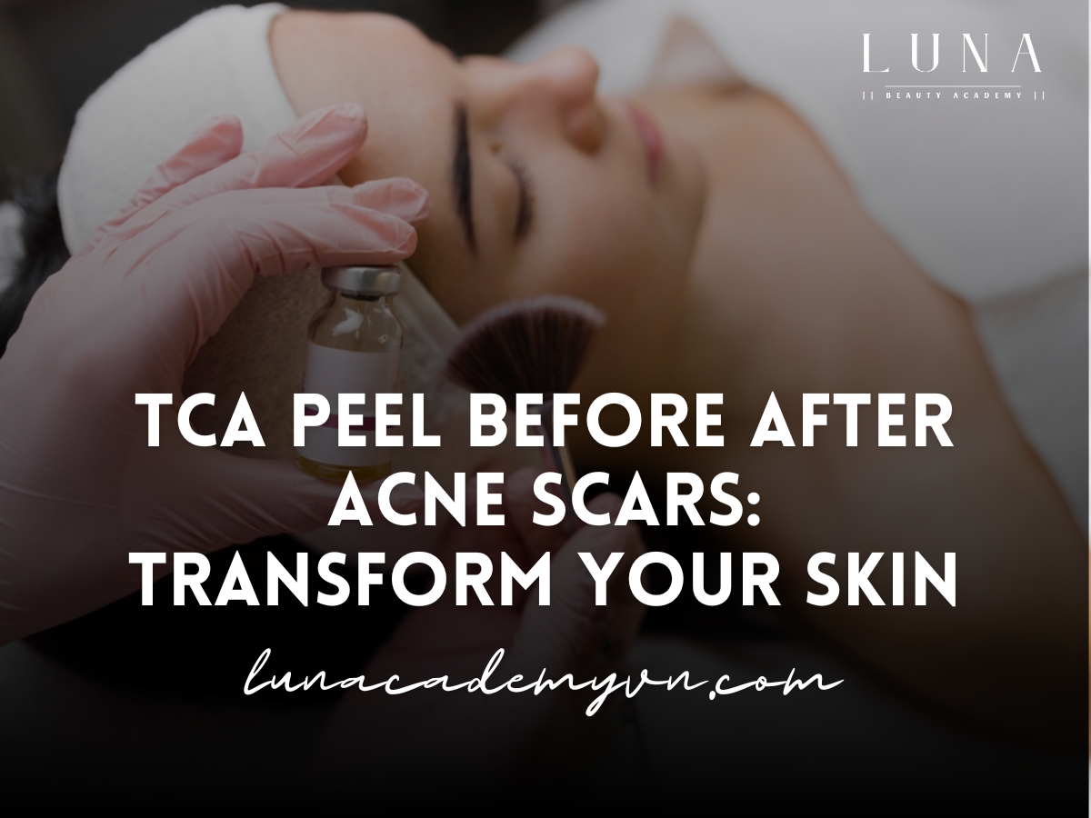 TCA Peel Before After Acne Scars