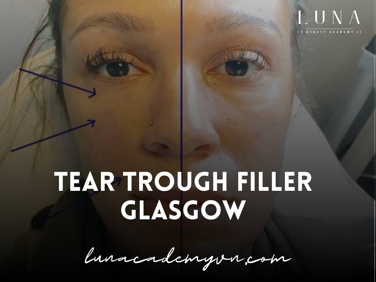 tear trough filler glasgow