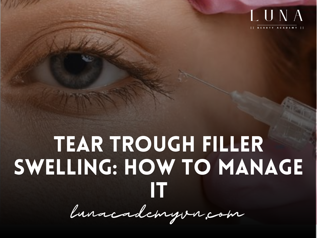 Tear Trough Filler Swelling: How to Manage It