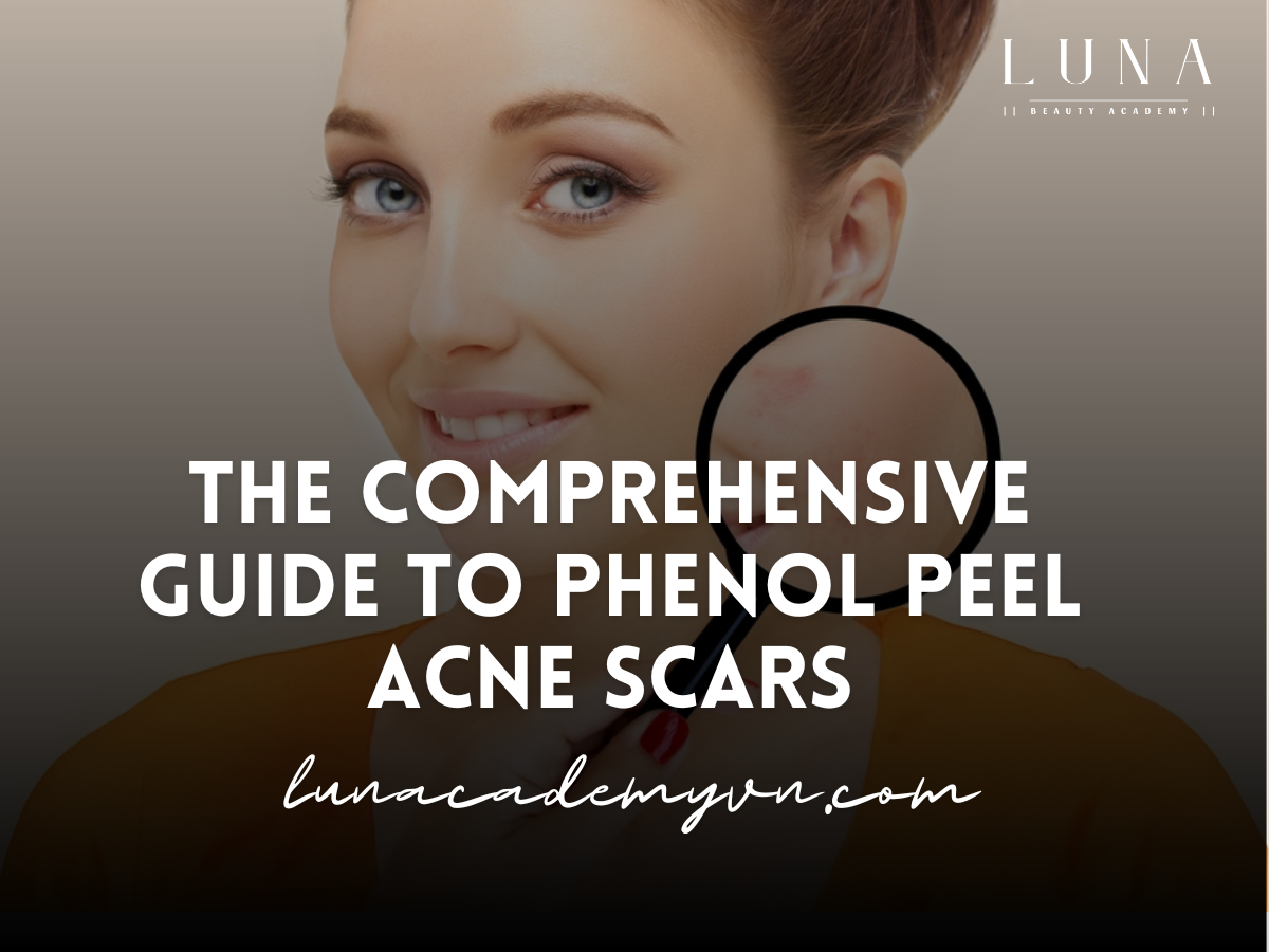 The Comprehensive Guide to Phenol Peel Acne Scars