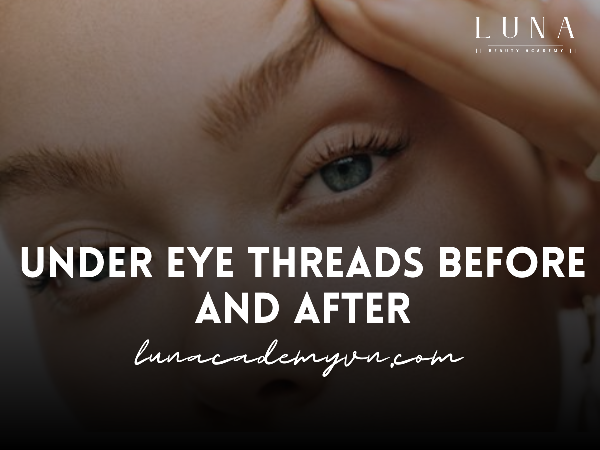 Under Eye Threads Before and After