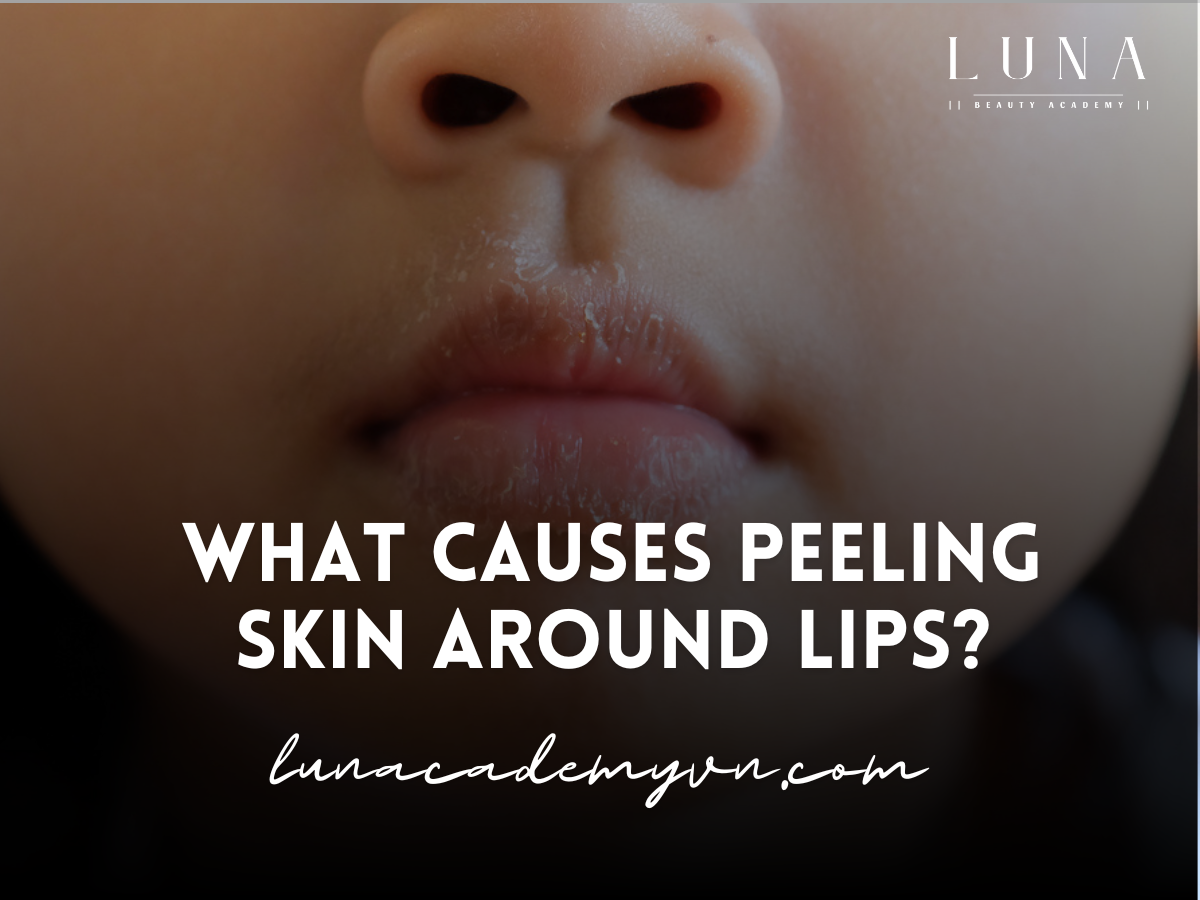 What Causes Peeling Skin Around Lips?