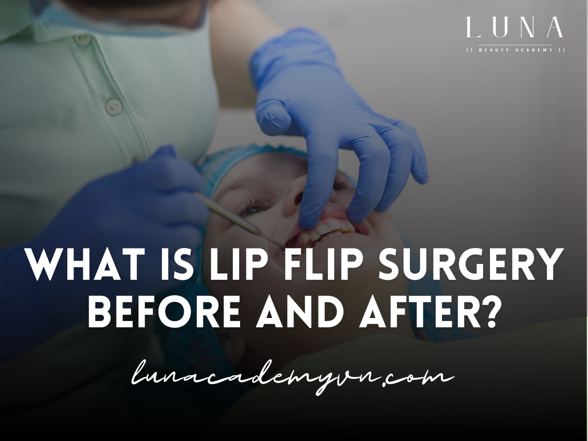 What is Lip Flip Surgery Before and After?