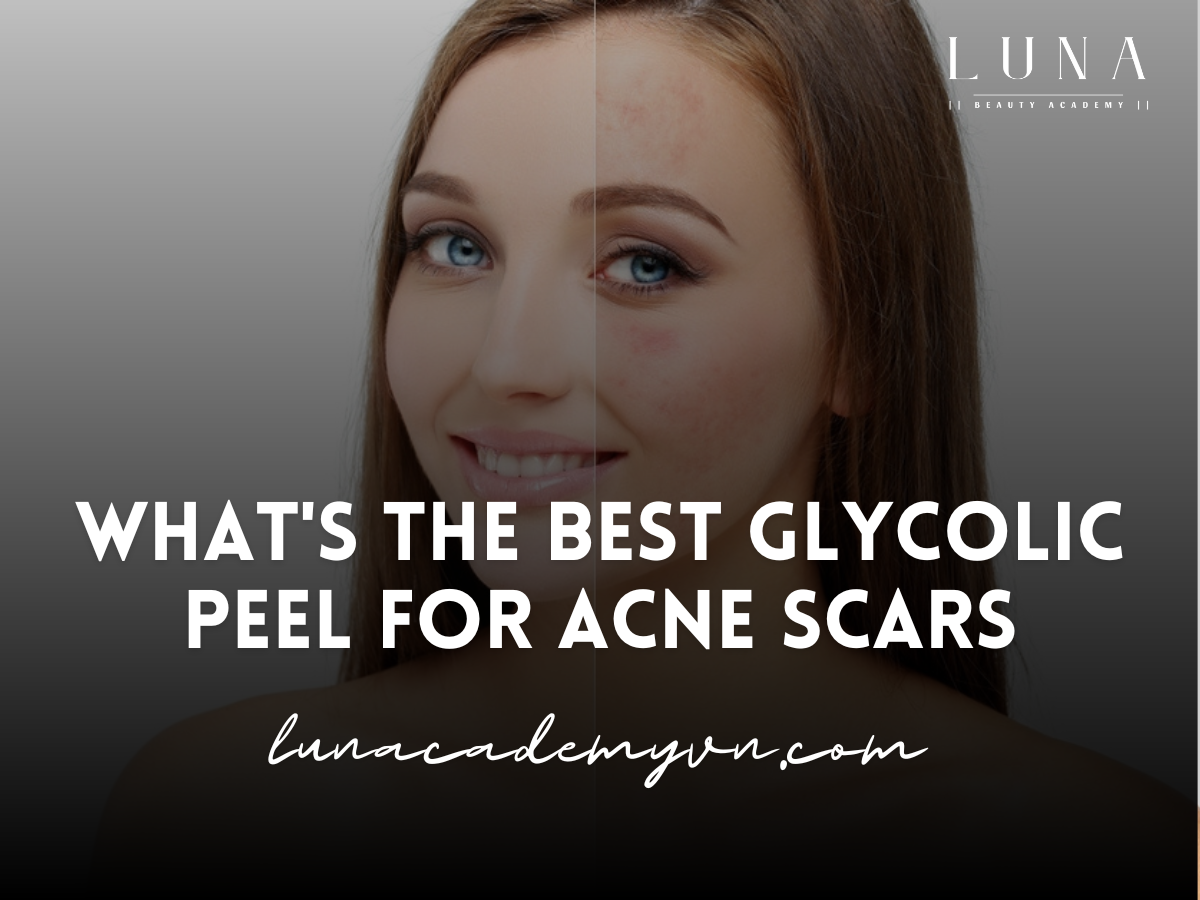 what's the best glycolic peel for acne scars