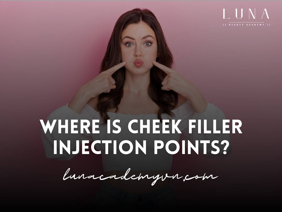 cheek filler injection points