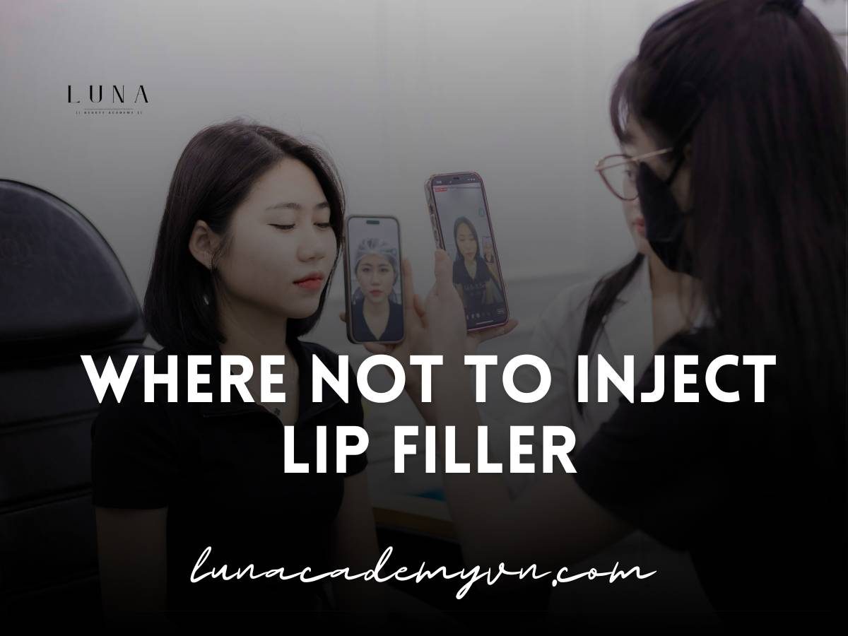 where not to inject lip filler