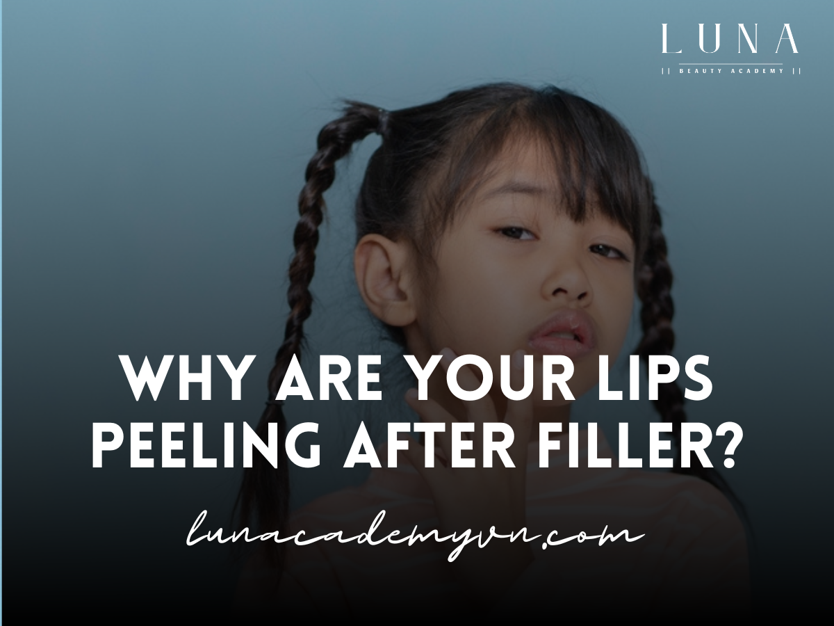 Why Are Your Lips Peeling After Filler?