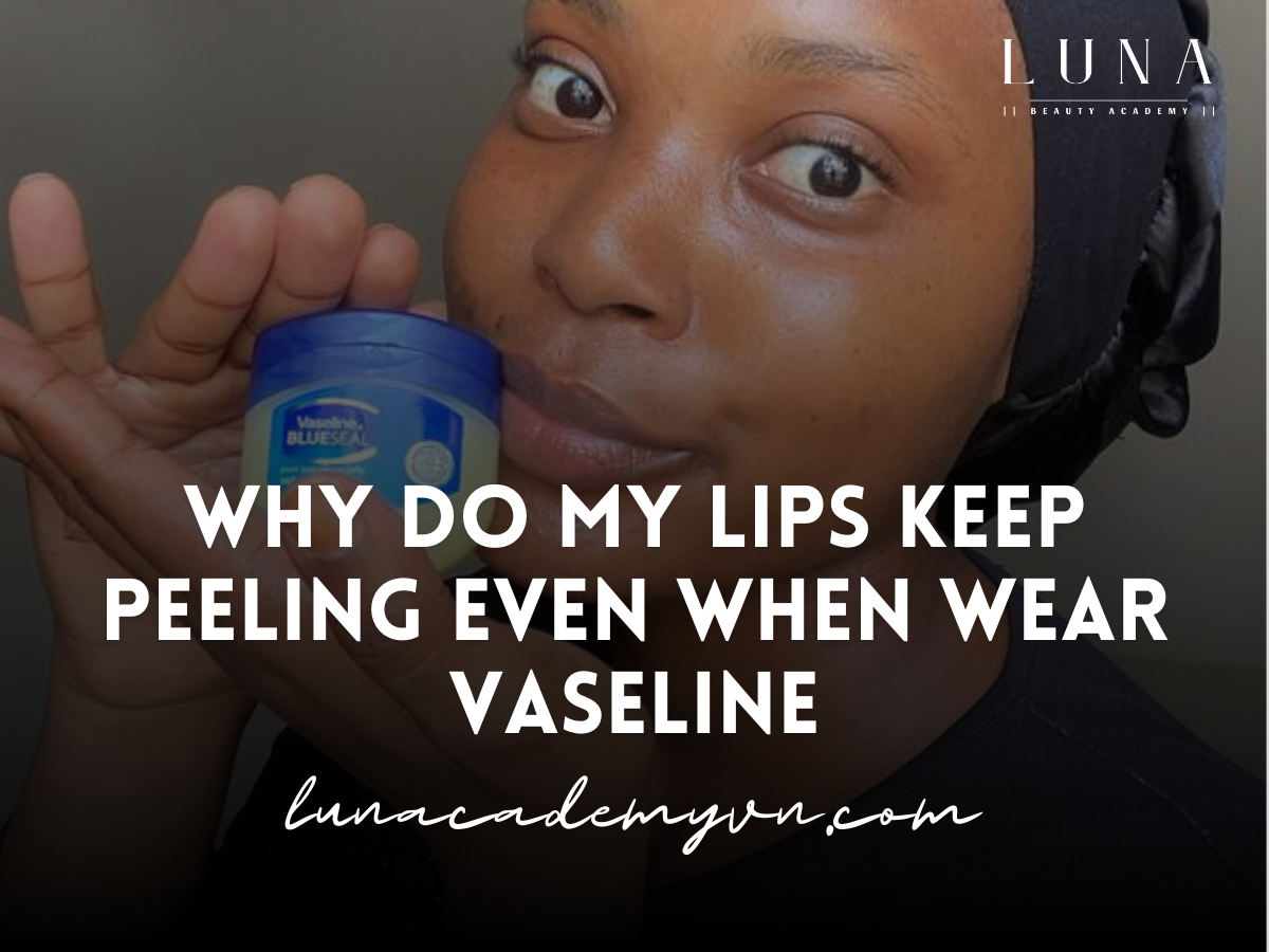 why do my lips keep peeling even when wear vaseline