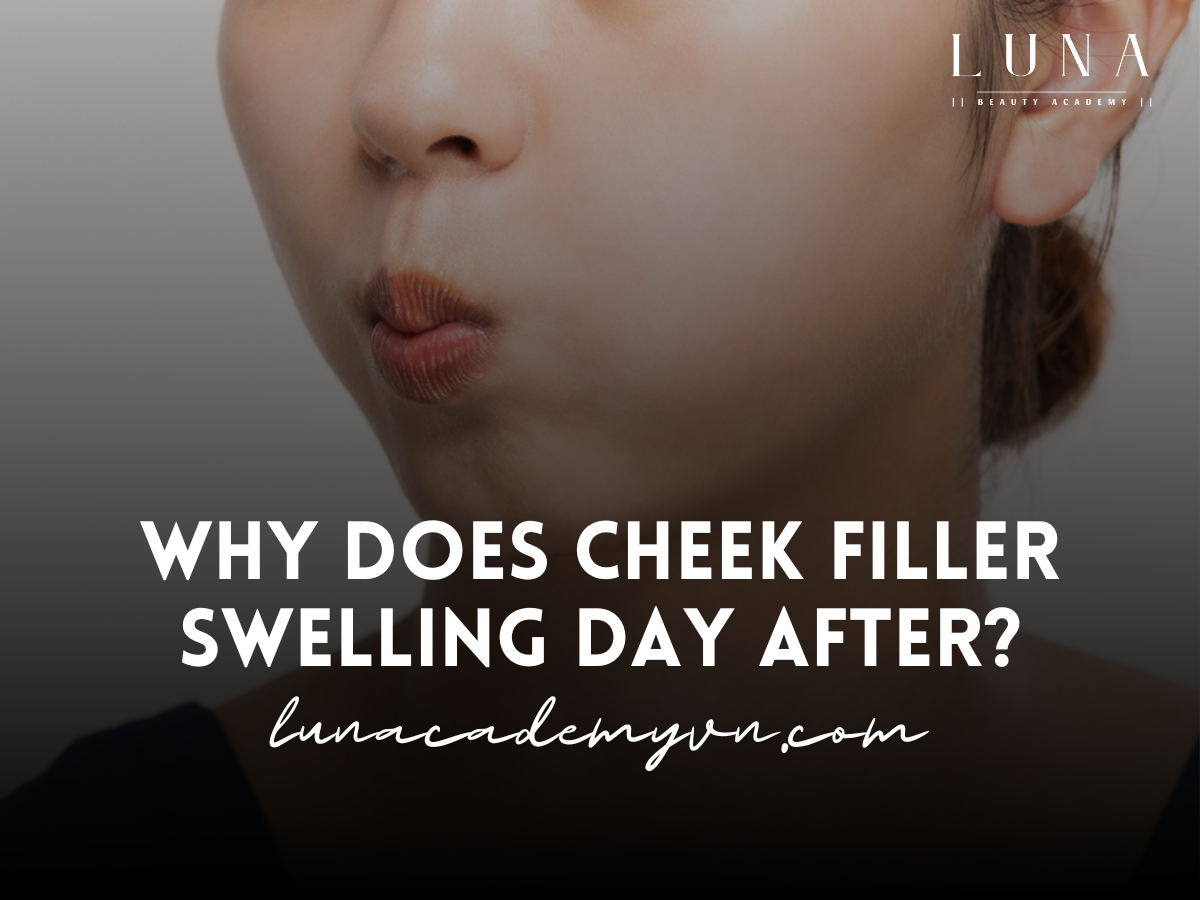 why does cheek filler swelling day after ?