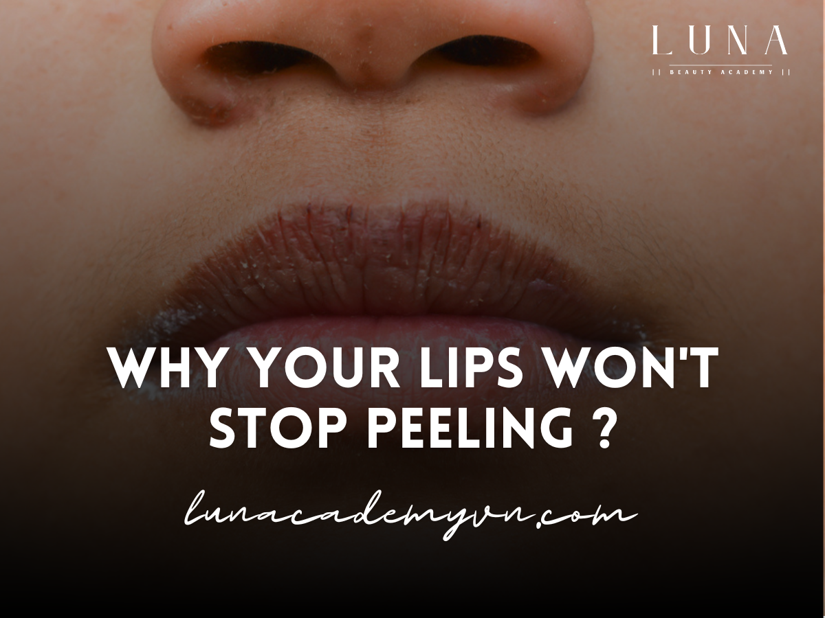 Why Your Lips Won't Stop Peeling ?